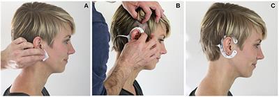 Concealed, Unobtrusive Ear-Centered EEG Acquisition: cEEGrids for Transparent EEG